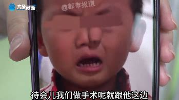 3岁男孩患象鼻病全球仅34例 鼻子旁边“又长”鼻子