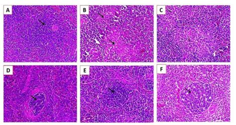 Molecular Characterization of Velogenic Newcastle Disease Virus (Sub ...