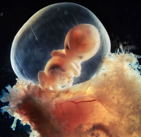 孕早期胎芽胎心是同时出现吗？做到5个“避免”，远离胎停_胎儿