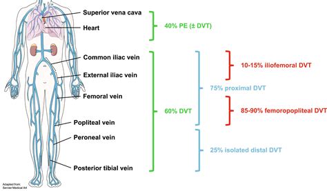 Epidemiology of deep vein thrombosis | Vasa