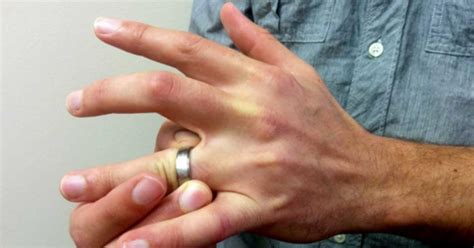 Image result for Remove Stuck Compression Ring