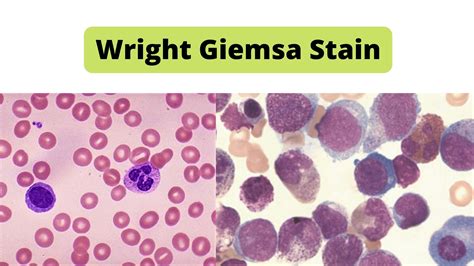 Wright Giemsa Stain Archives - Biology Notes Online