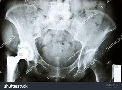 15 Interventional Radiology Joints Images, Stock Photos & Vectors | Shutterstock