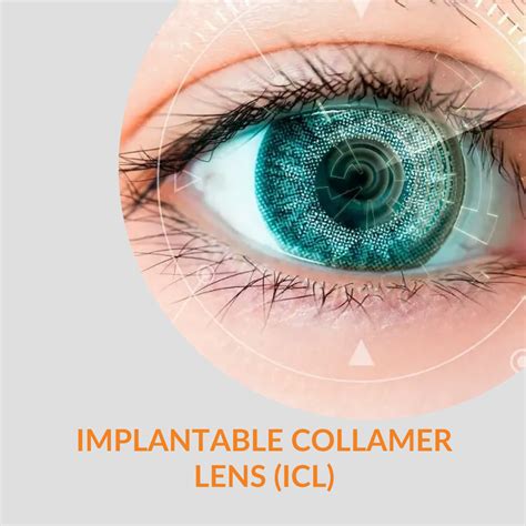 Centre for Implantable Collamer lens Surgery l ICL Surgery