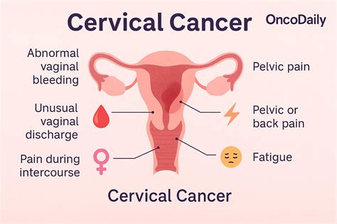 Cervical Cancer: Symptoms, Causes, Stages, Diagnosis and Treatment ...