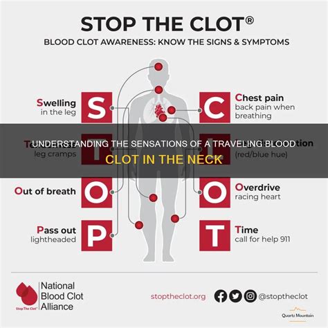 Understanding The Sensations Of A Traveling Blood Clot In The Neck | QuartzMountain