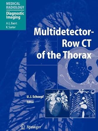 Multidetector-Row CT of the Thorax : U. Joseph Schoepf: Amazon.in: Books