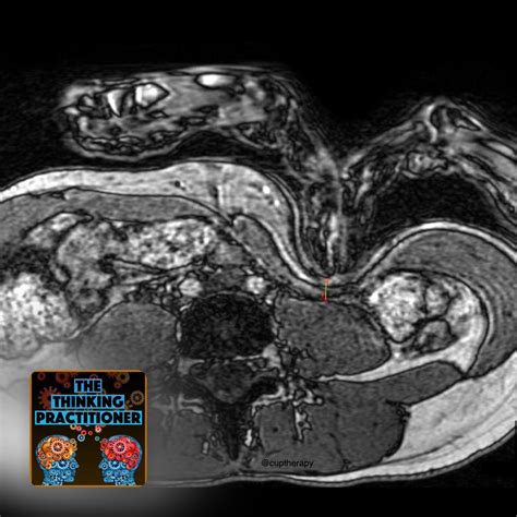 159: Can You Really Palpate th... - The Thinking Practitioner - Apple ...