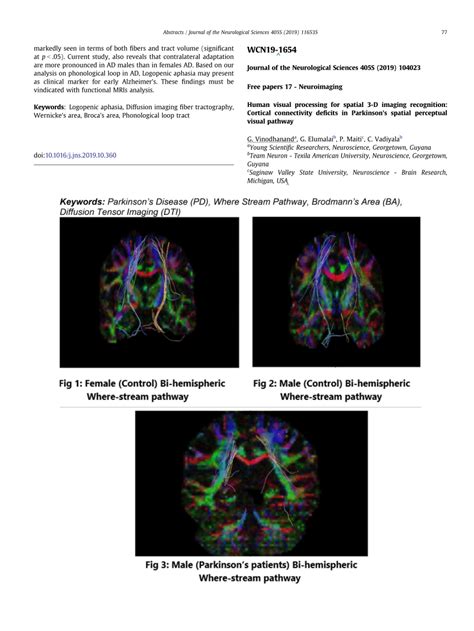 Image result for Visual Spatial Disorder