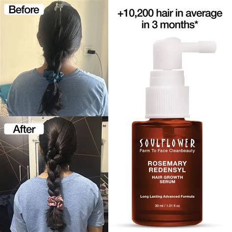 Soulflower Rosemary Redensyl Hair Growth Serum