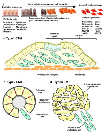The Role of MicroRNA in the Regulation of Tumor Epithelial–Mesenchymal ...