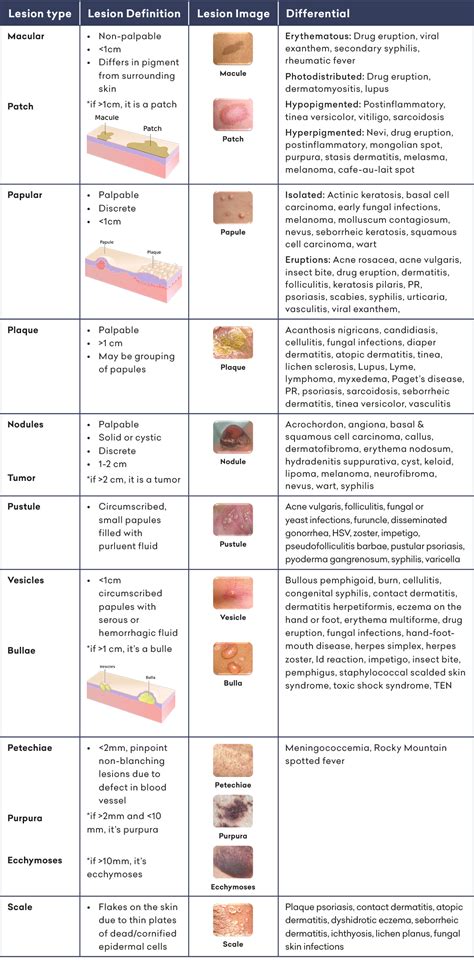 Dermatology Terminology Of Skin Lesions Terminology Of Skin Lesions