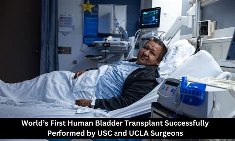 World's First Human Bladder Transplant Successfully Performed by USC ...
