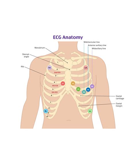Pediatric Ecg Electrode Placement