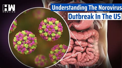 Is Norovirus Airborne