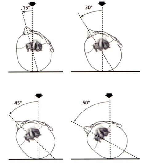 Image result for Contralateral Head Rotation