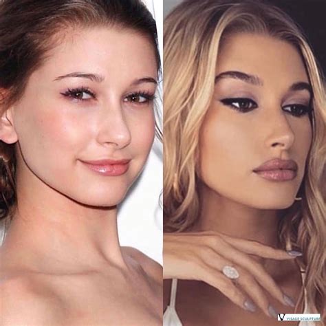 Bildergebnis für lip+fillers+for+celebrities