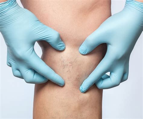 Best Ways to Protect Your Blood Vessels | Newsmax.com