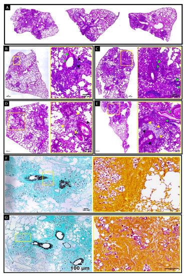 Adjuvant Curdlan Contributes to Immunization against Cryptococcus ...
