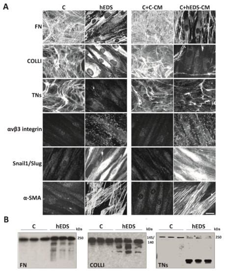 Matrix Metalloproteinases Inhibition by Doxycycline Rescues ...