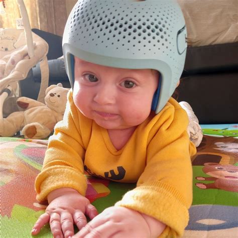 What Age Do Babies Have To Wear Helmets at Sandie Ambler blog