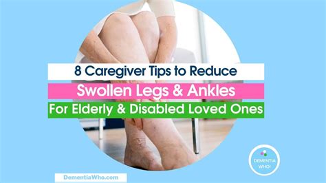 8 Caregiver Tips to Reduce Swollen Legs and Ankles for Elderly & Disabled - DementiaWho!