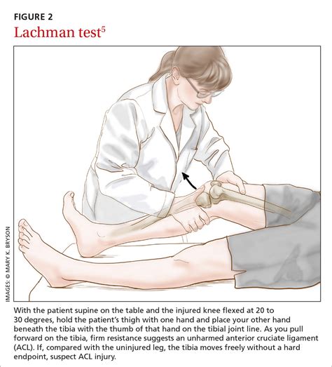 Posterior Drawer Test