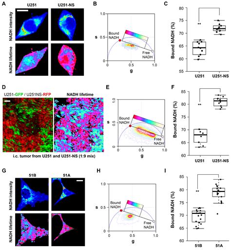 Tracking Functional Tumor Cell Subpopulations of Malignant Glioma by ...