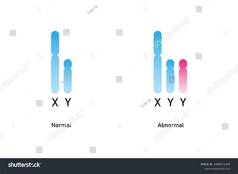 Xyy Syndrome Science Design Vector Illustration Stock Vector (Royalty Free) 2588371395 ...