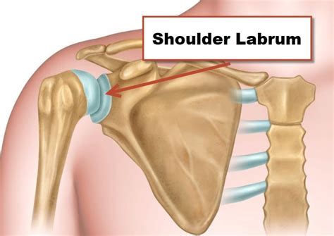 Labrum Test 的图像结果