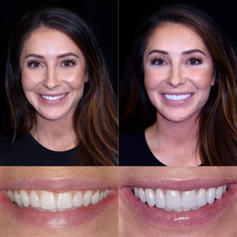 Home | Fine Dental Clinic - Dr Latha