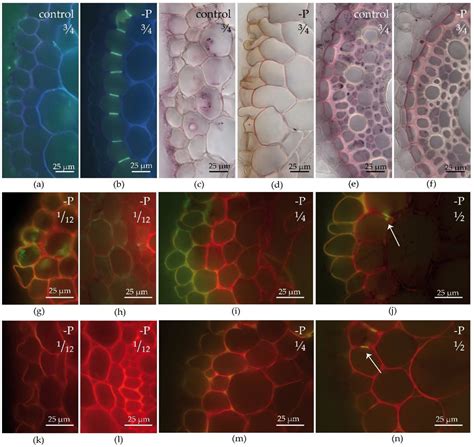 Exodermis and Endodermis Respond to Nutrient Deficiency in Nutrient ...