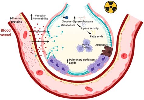 The Role of Pulmonary Surfactant Phospholipids in Fibrotic Lung Diseases