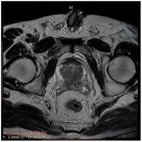 Pathophysiology | Topical Collection : Feature Papers in Pathophysiology