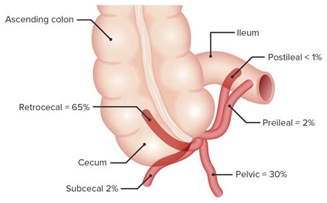 Image result for Appendix Variants
