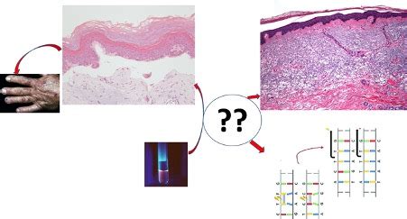 Dermatopathology Society of India Mid-Month Mindbender