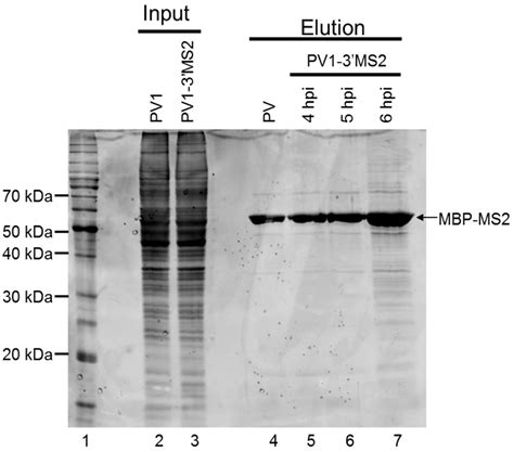 Generation of Recombinant Polioviruses Harboring RNA Affinity Tags in ...
