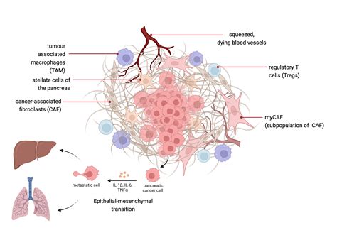 Pancreatic Tumor Metastasis