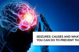 Image result for seizures