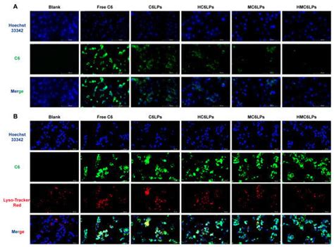 Celastrol-Loaded Hyaluronic Acid/Cancer Cell Membrane Lipid ...