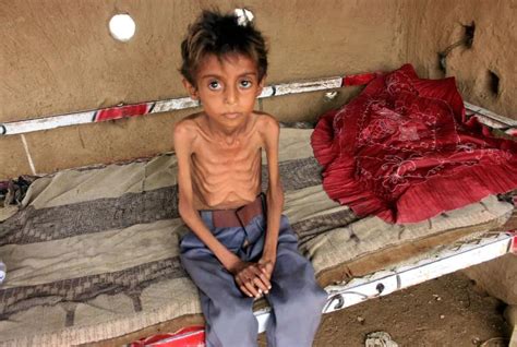 Hunger 的图像结果