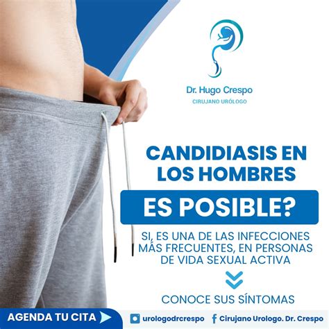 Candidiasis En Hombres Estos Son Los Sintomas Mas