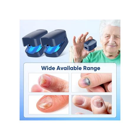 2 Pack Nail Fungus Cleaning Laser Treatment Device, India | Ubuy