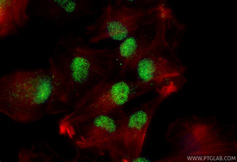 RUNX2 antibody (20700-1-AP) | Proteintech