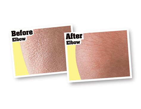 O'Keeffe's Skin Repair Body Lotion Tube, 7oz