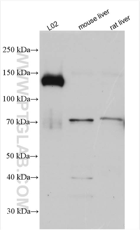 SREBF1 antibody (14088-1-AP) | Proteintech