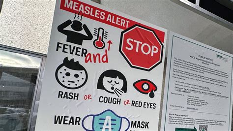 Measles in the US: Ohio officials confirm outbreak; spike in Kansas
