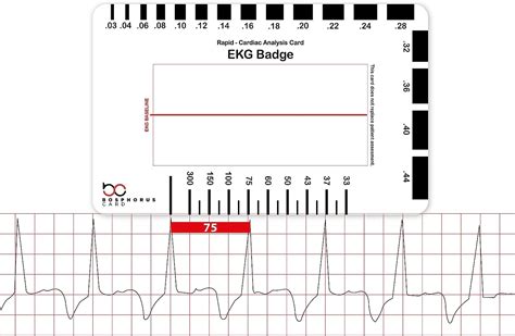 Image result for Telemetry Practice