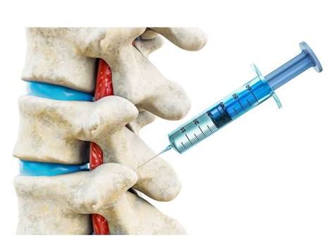 Injection Back Side 的图像结果