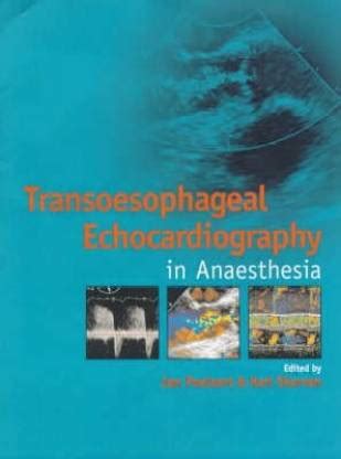 Transoesophageal Echocardiography in Anaesthesia: Buy Transoesophageal ...